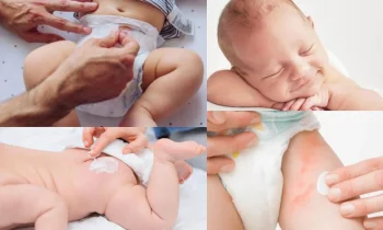 Mustela Pişik Kremi Doğal İçerikli Mi?