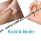 Selülit Nedir
